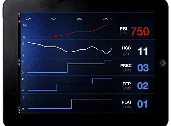 gauss estimation ipad